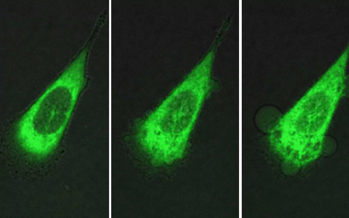 علماء يطورون تقنية جديدة تقتل الخلايا السرطانية فى 60 ثانية 60320-nano-blebbing_trans_NvBQzQNjv4BqZPnXlBHEdt8AtjizIYNgmXGTJFJS74MYhNY6w3GNbO8