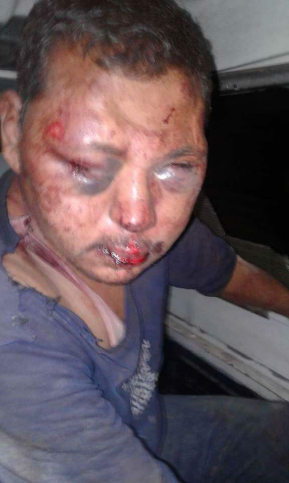 المجني عليه يعاني من جروح وكدمات (3)