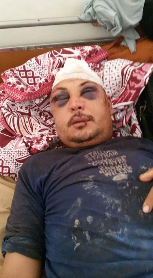 المجني عليه يعاني من جروح وكدمات (1)