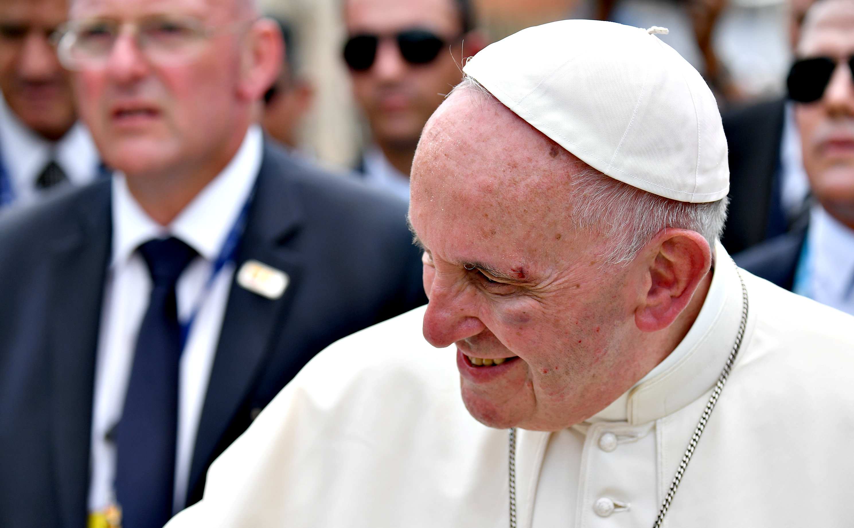 البابا يبتسم ويستكمل جولاته رغم الاصابة