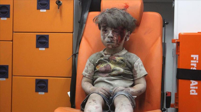 الطفل عمران السورى