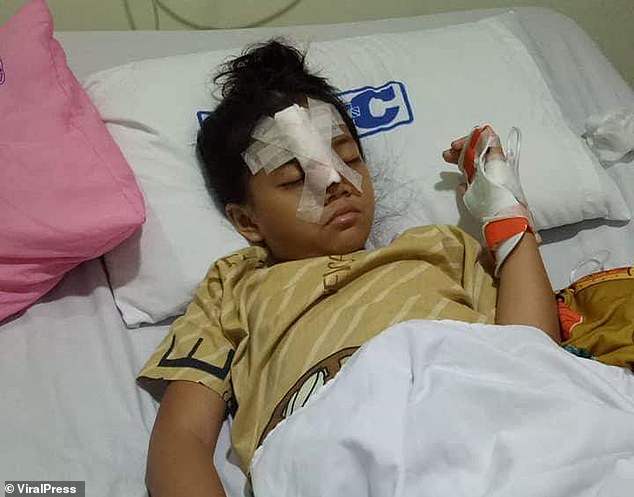 الطفلة ترقد فى المشفى بعدما هاجمها اللصوص