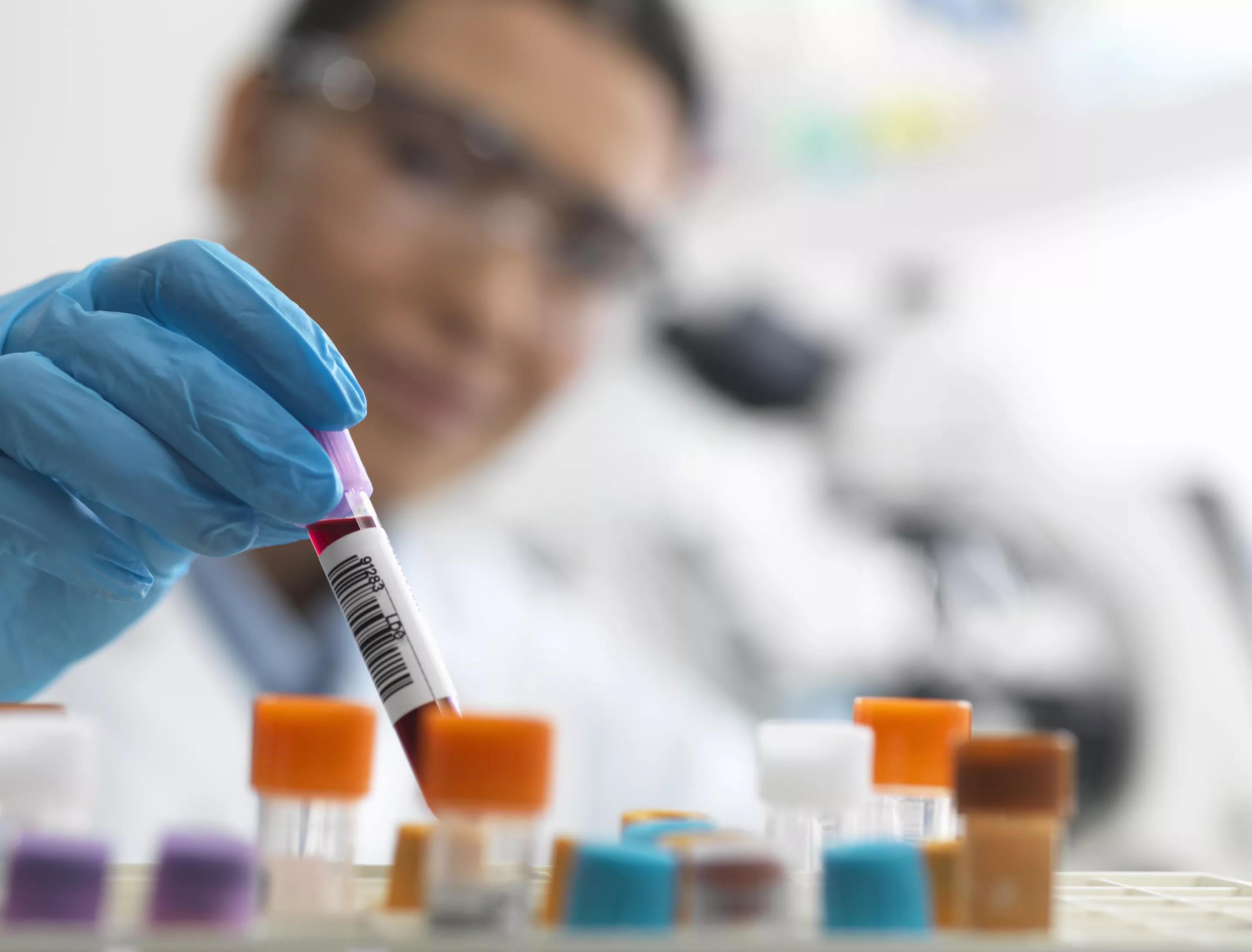 الكوليسترول من علامات اضطراب الغدة الدرقية الكوليسترول من علامات اضطراب الغدة الدرقية