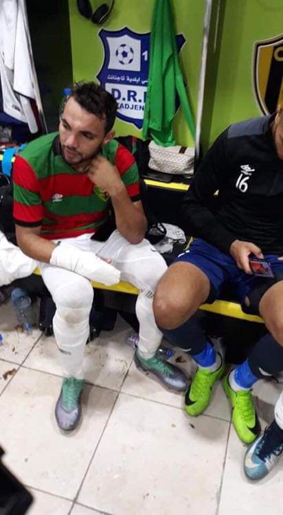 اصابات لاعبى مولودية الجزائر بعد اعتداء جماهير بوعريريج (3)
