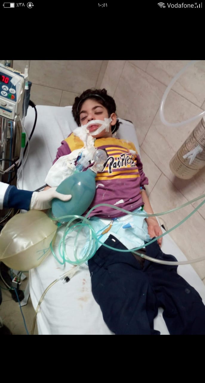 مأساة طفل بالغربية يعيش على أجهزة التنفس (3)