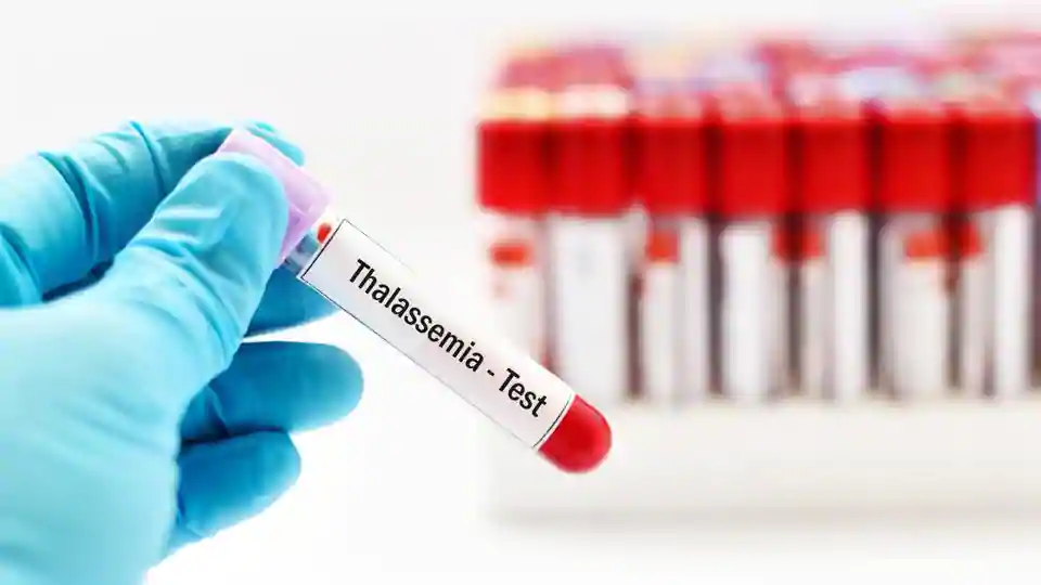 الثلاسيميا من امراض الدم الوراثية