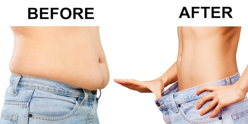 قبل وبعد عملية شفط الدهون