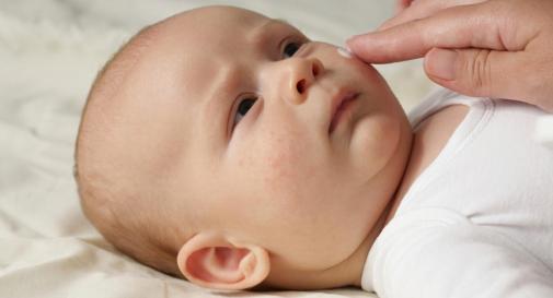 علاج الطفح الجلدي عند الاطفال بالشوفان