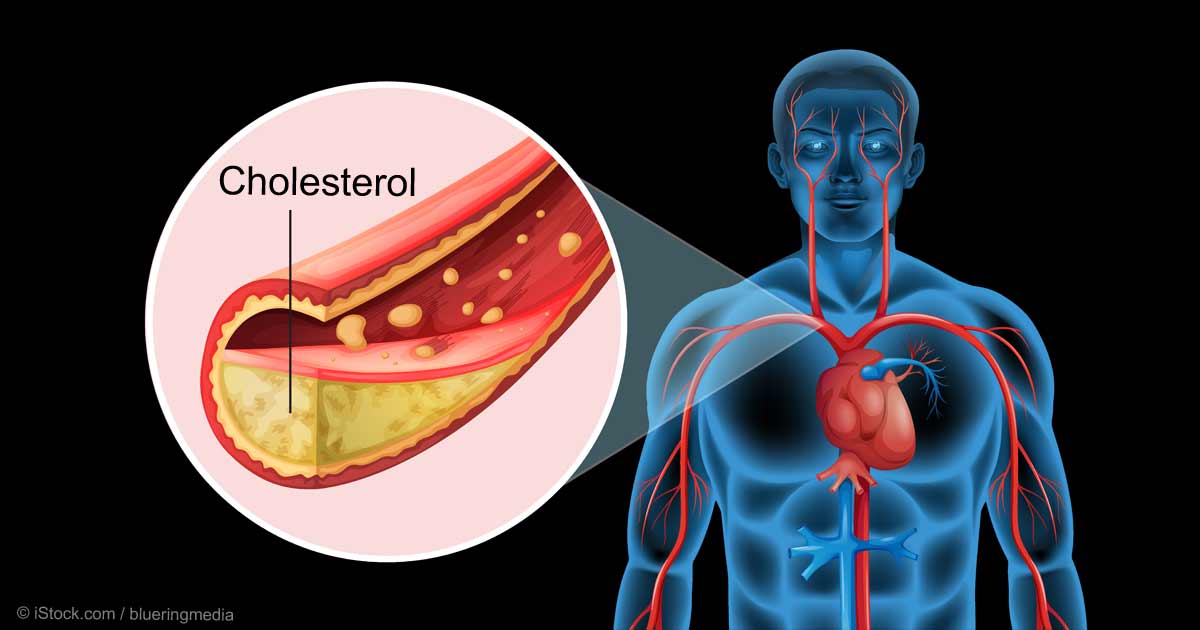 اسباب ارتفاع الكوليسترول فى الدم