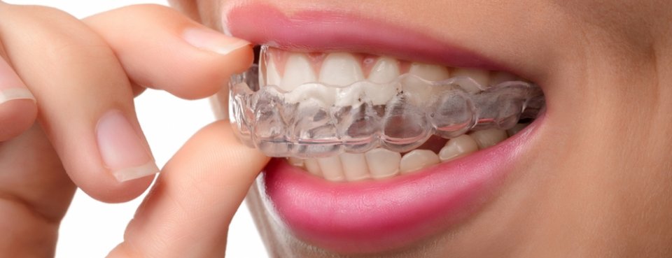 اعراض صداع الاسنان وعلاجها بجهاز لمنع الجز علي الأسنان