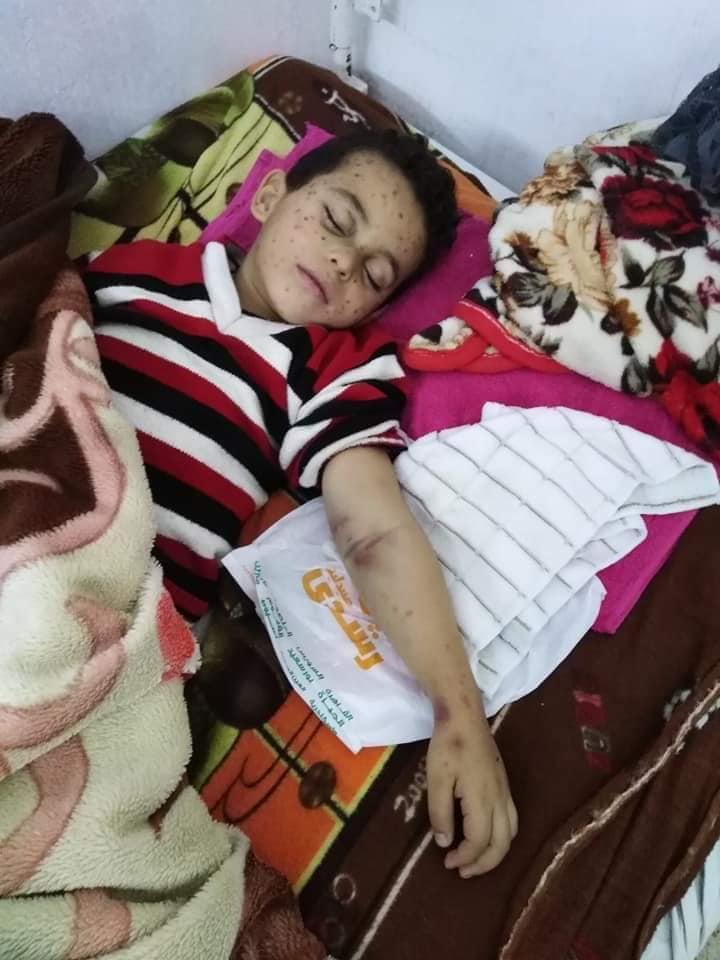 الطفل محمد إبراهيم محمد إبراهيم 5 سنوات مُصاب بسرطان الدم (3)