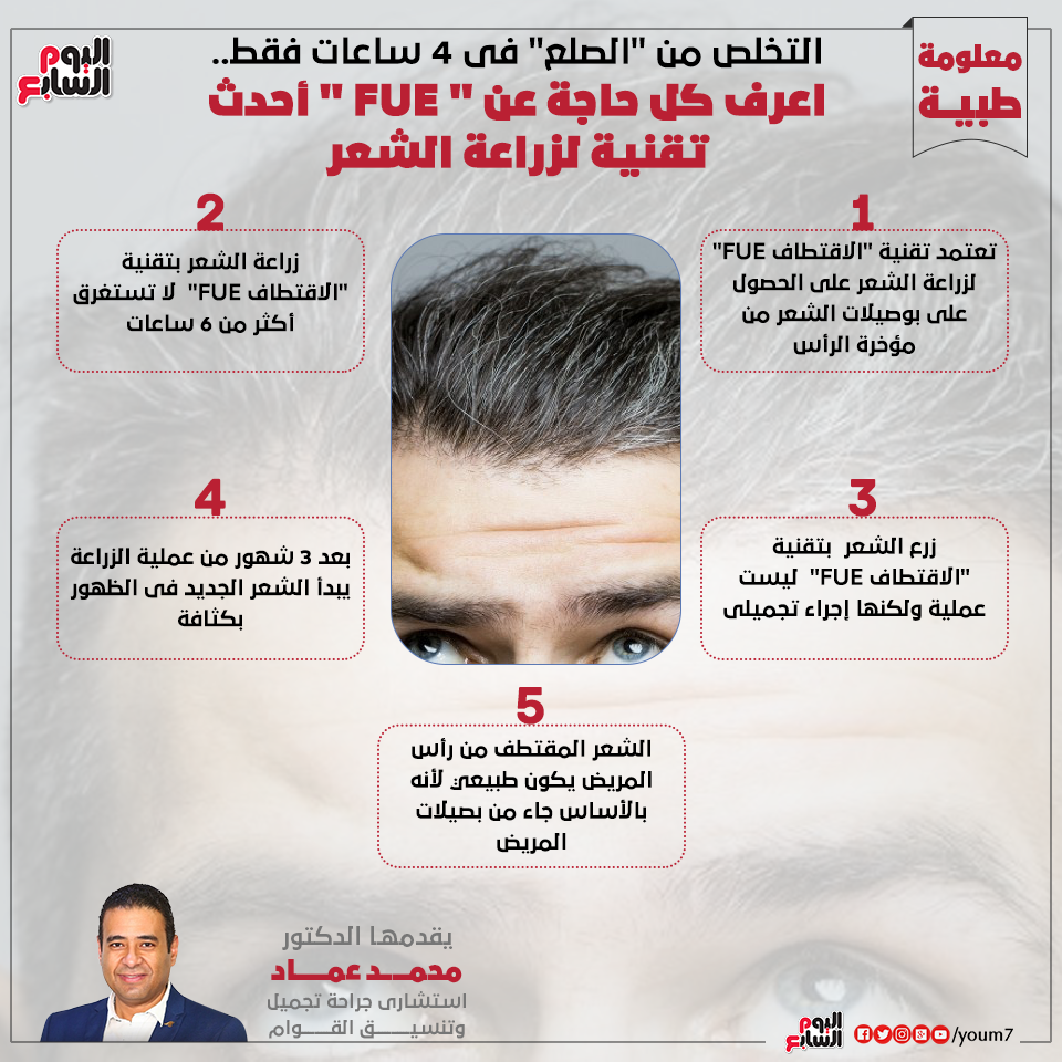 إنفوجراف دكتور محمد عماد يقدم معلومات هامة عن زراعة الشعر بتقنية FUE