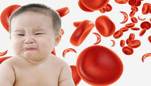 فقر الدم عند الاطفال
