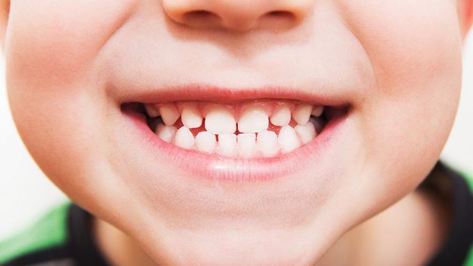 نقل على نطاق واسع ميراث  اعرف جسمك.. ماهو عدد الأسنان لدى الأطفال والبالغين؟ - اليوم السابع