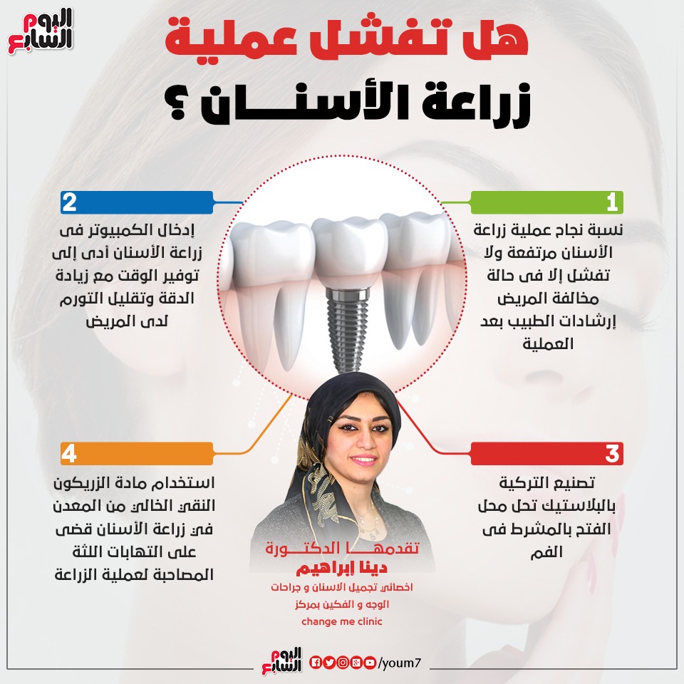 إنفوجراف دكتور دينا إبراهيم تقدم معلومات هامة عن زراعة الأسنان