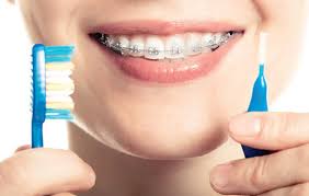 اثار تقويم الاسنان السلبية
