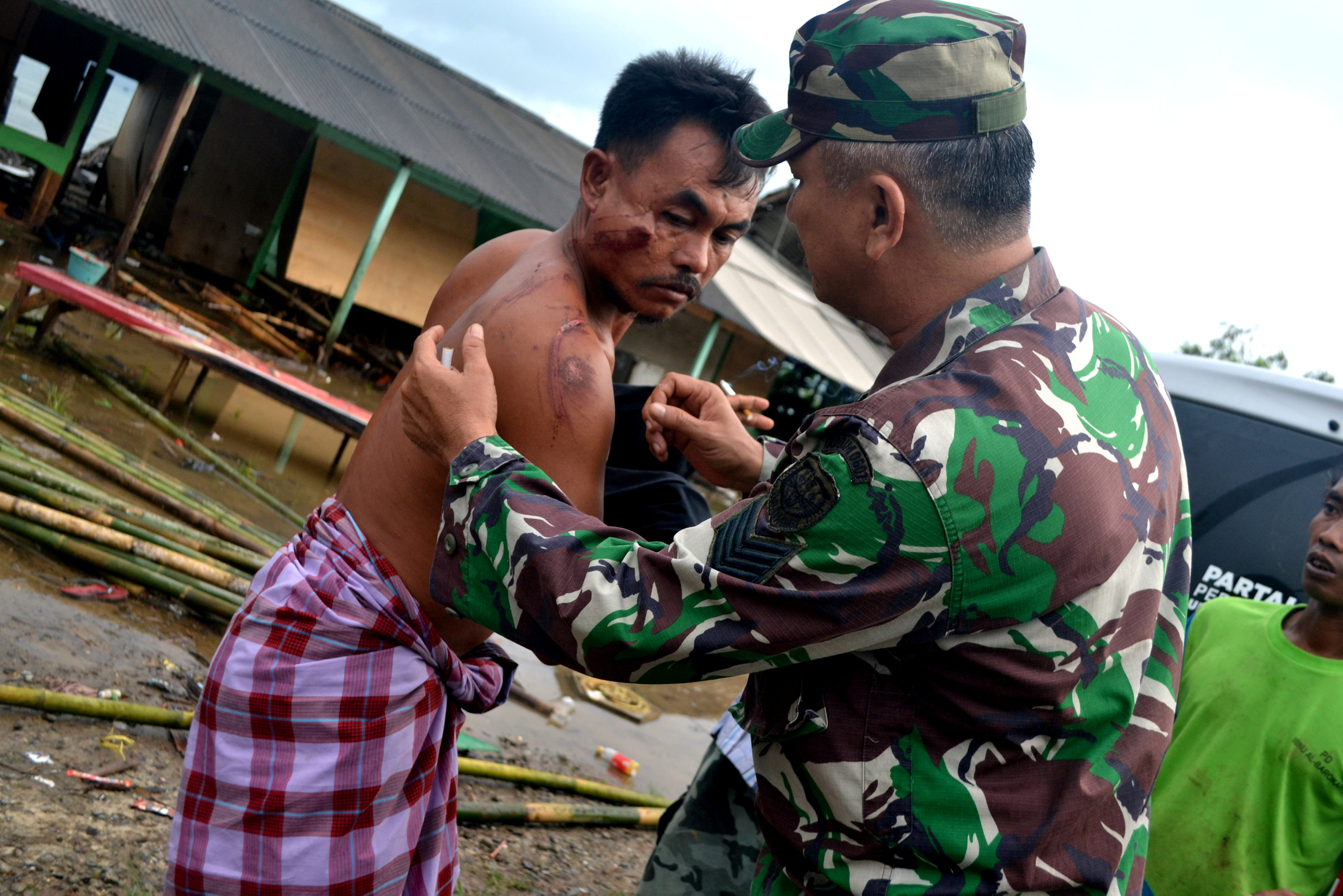 أحد المصابين جراء أمواج المد فى إندونيسيا