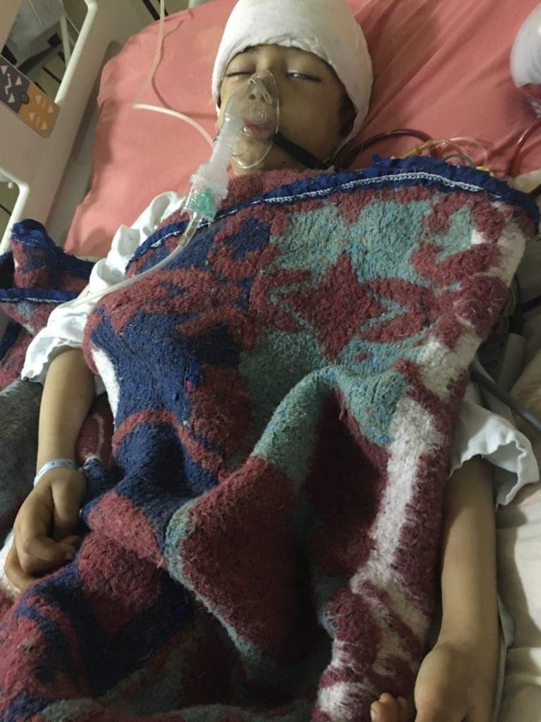الطفل محمد أشرف يتلقى العلاج