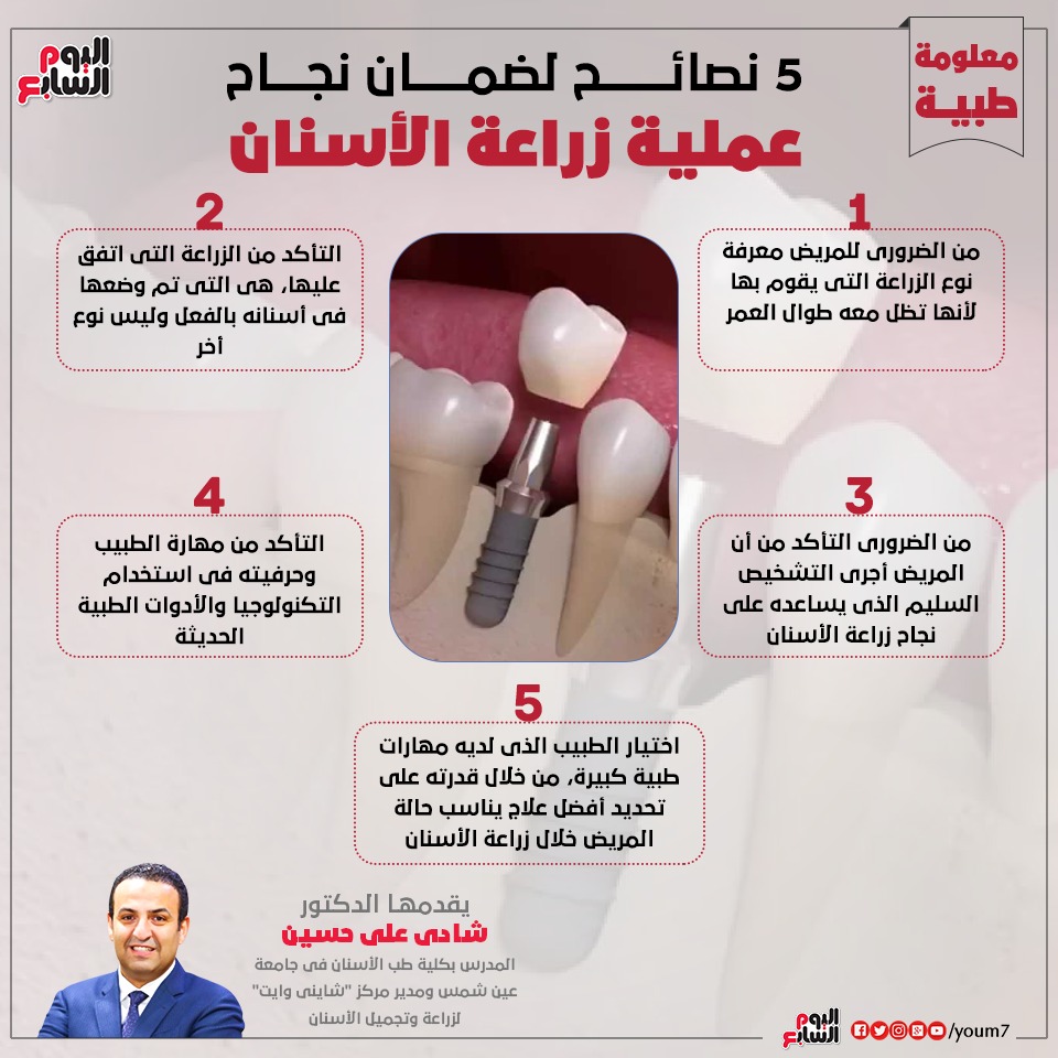زراعة الأسنان إنفوجراف دكتور شادى على حسين يقدم نصائح لنجاح العملية