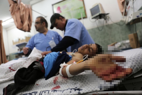 إصابة فلسطينى فى قصف مدفعى اسرائيلى
