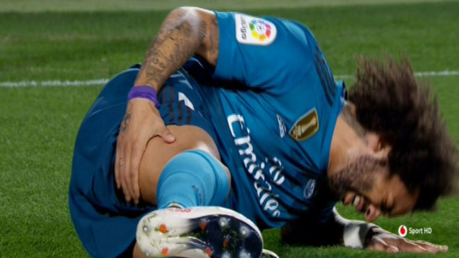اصابة مارسيلو نجم ريال مدريد
