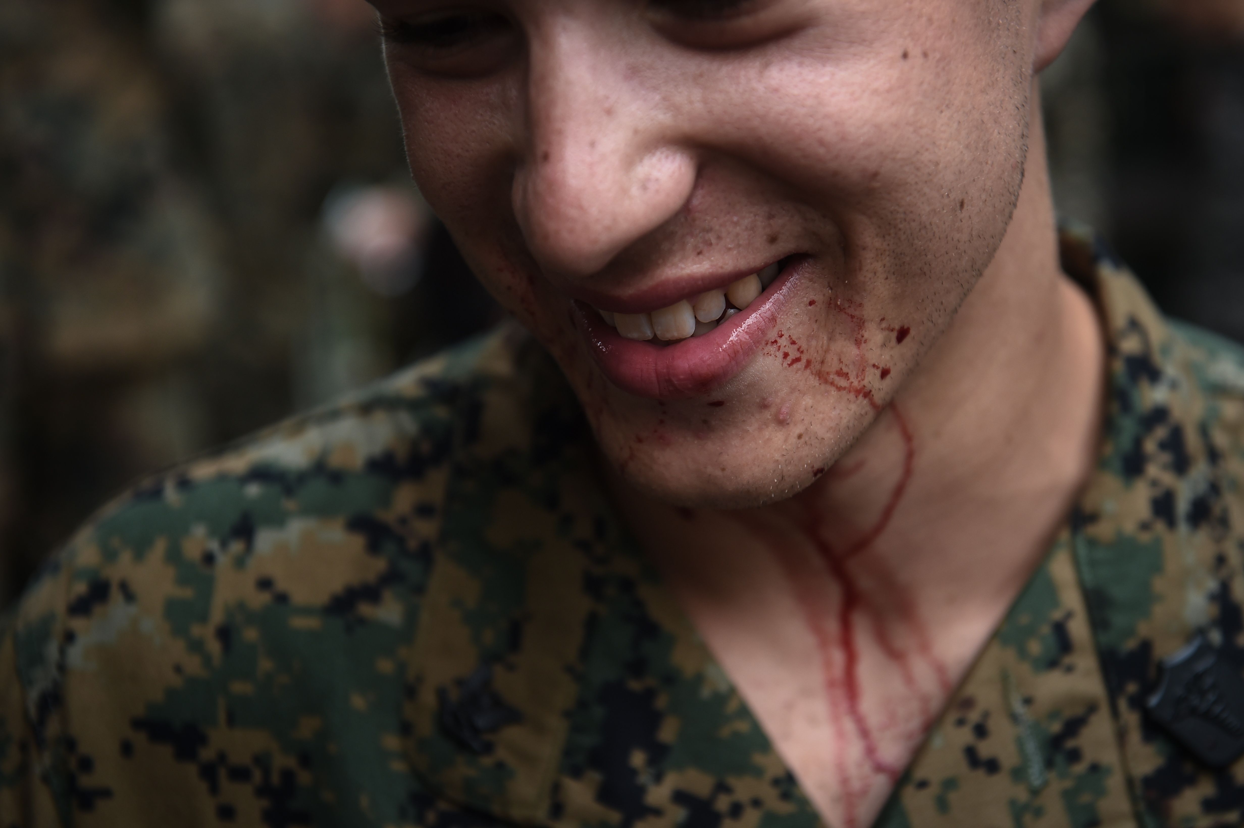أحد الجنود وقد تلطخ وجهه بالدماء