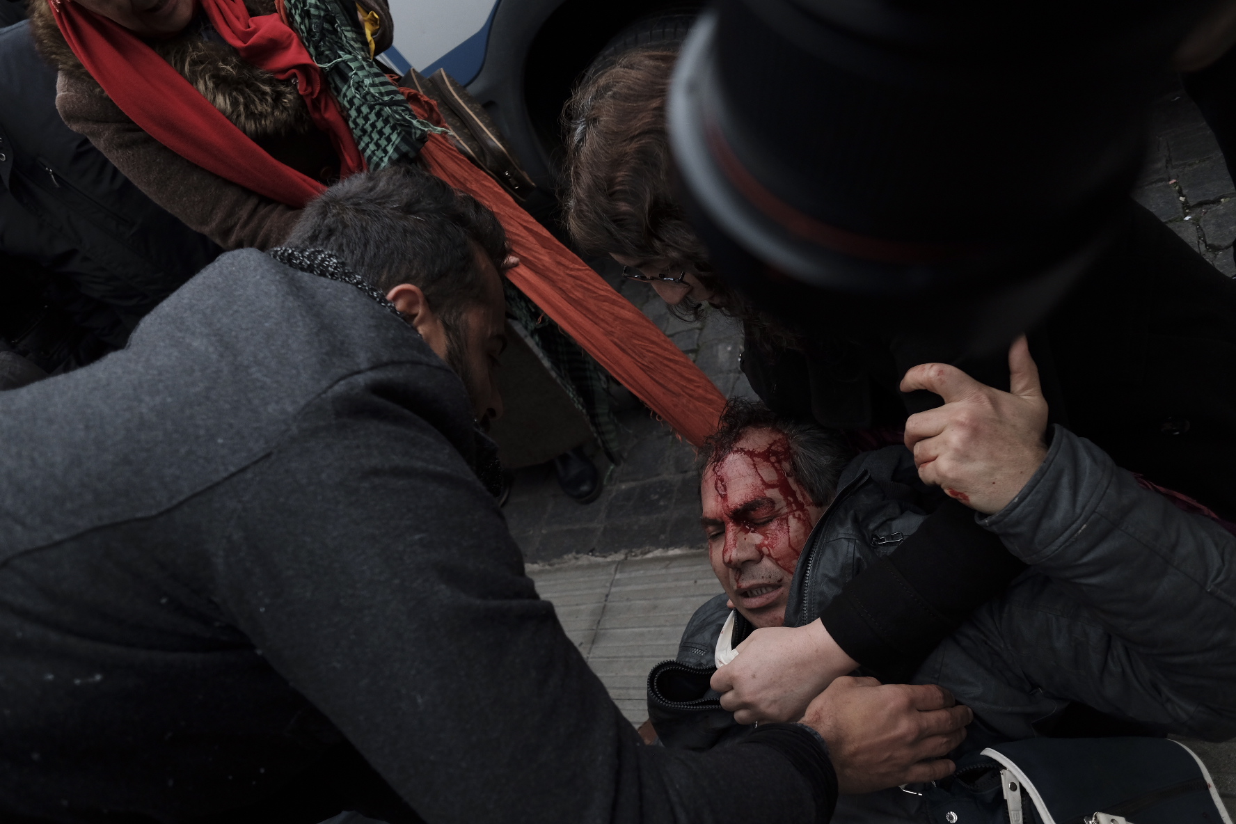 الدماء تسيل من رأس أحد المحتجين