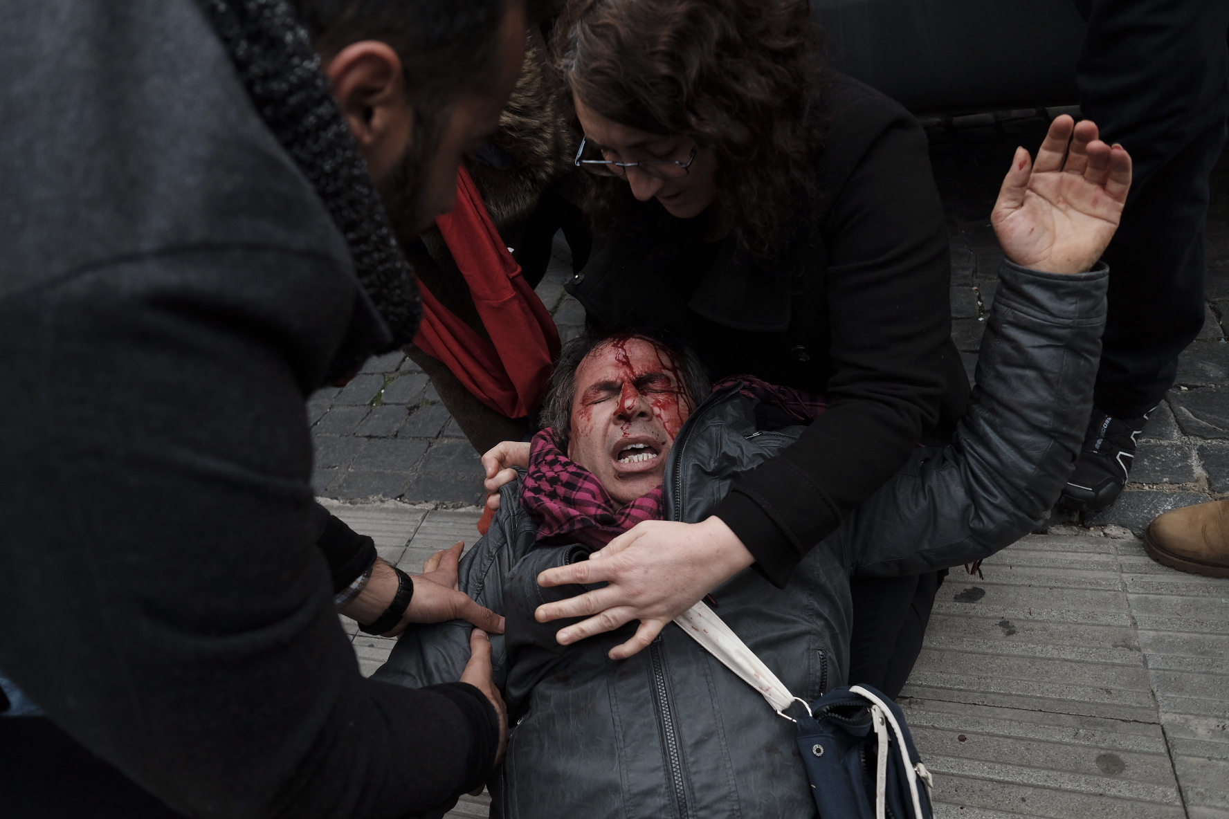 اشتباكات وإصابات فى روما احتجاجا على زيارة أردوغان إلى إيطاليا