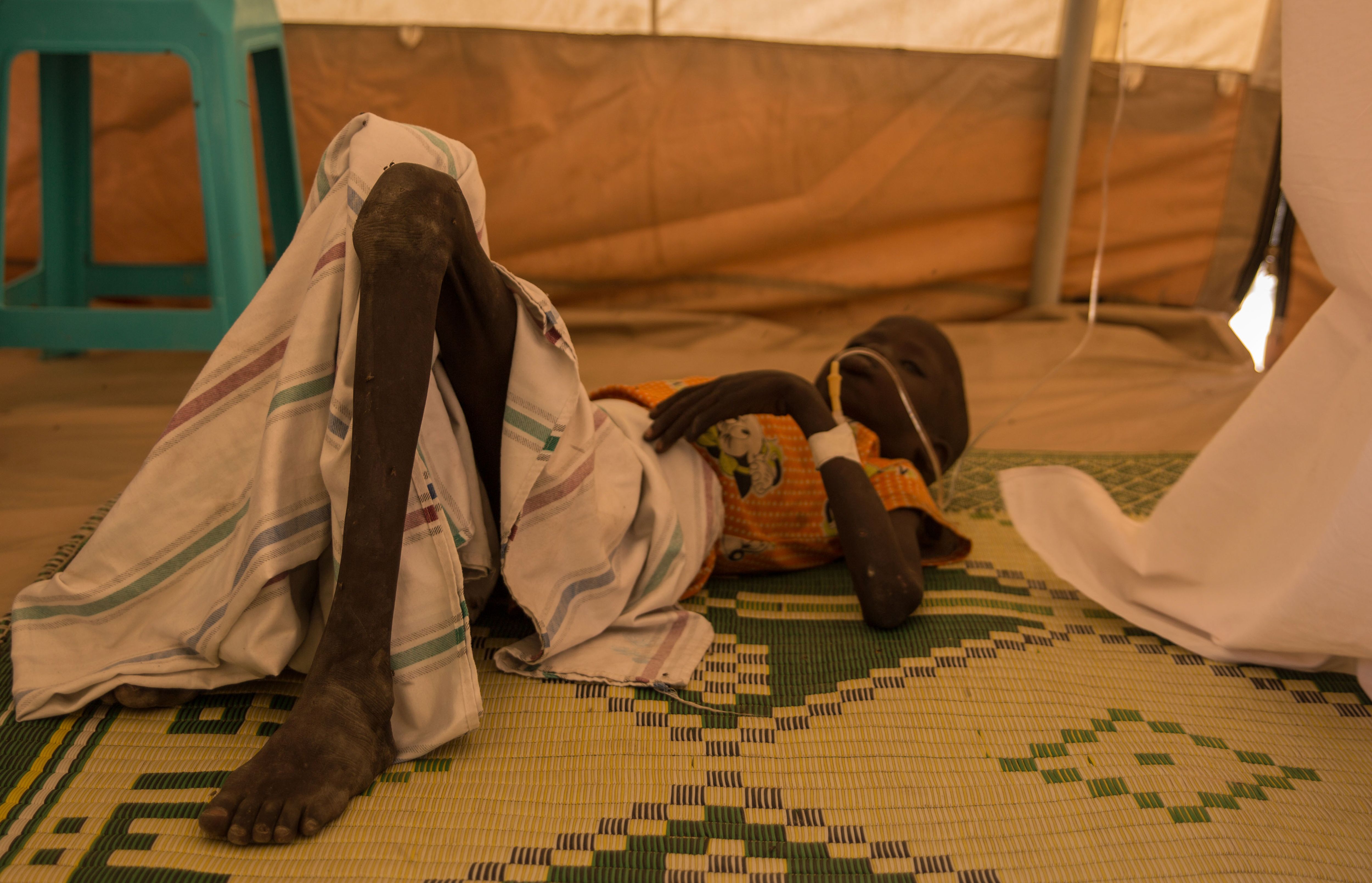 مريض فى بلدة لير بجنوب السودان