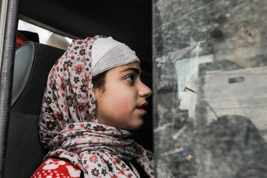 طفلة سورية مصابة أثناء نقلها من الغوطة الشرقية