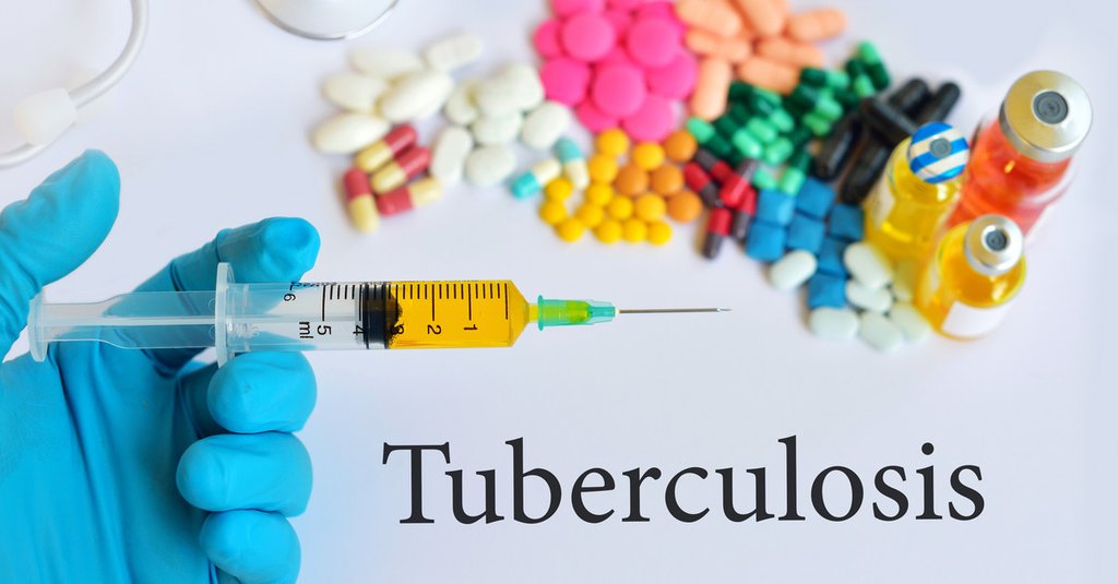 tuberculosis_needle