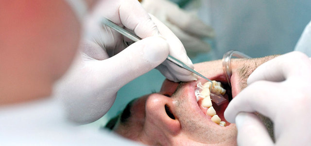 كيفية السيطرة على الم الاسنان بعد الحشو