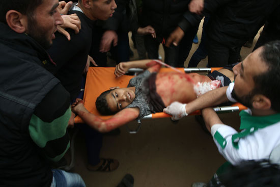إصابة-طفل-فلسطينى