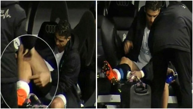 اصابة رونالدو فى مباراة ريال مدريد وخيتافى