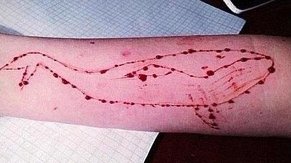 رسمة الحوت الأأزرق على جسد الضحايا رسمة الحوت الأأزرق على جسد الضحايا
