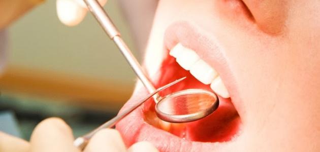 نصائح لعلاج آلام الاسنان خلال الحمل اليوم السابع