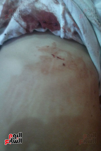 طفلة تنزف دما بالدقهلية من فتحات جسمها (15)