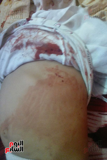 طفلة تنزف دما بالدقهلية من فتحات جسمها (31)