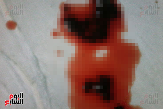 طفلة تنزف دما بالدقهلية من فتحات جسمها (1)