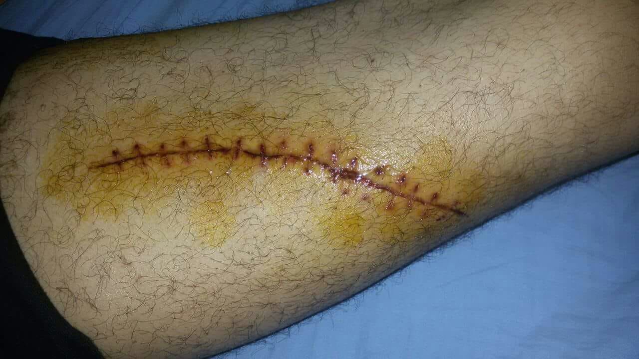 WhatsApp Image 2018-05-29 at 12.22.52 PM WhatsApp Image 2018-05-29 at 12.22.52 PM