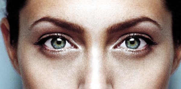 اصفرار العين بين اعراض الانيميا