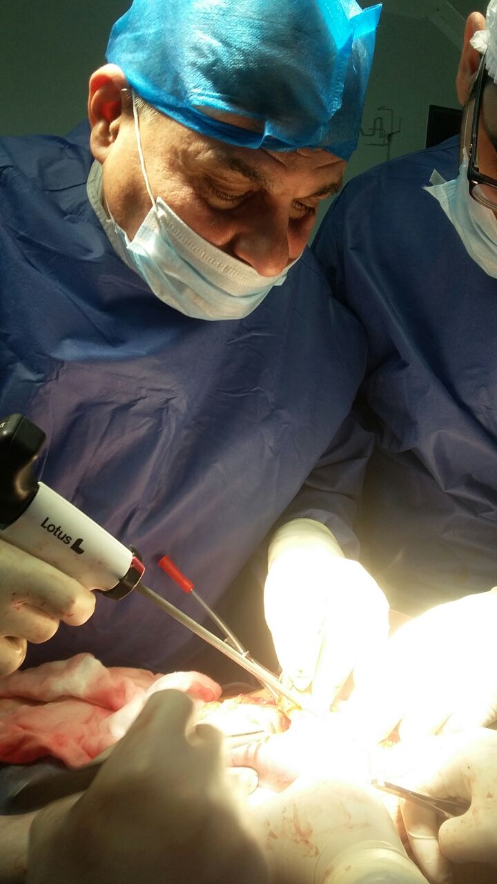 اجراء اول عملية استئصال ورم بالمرئ وتكوين أنبوبة من المعدة وتمريرها داخل الصدر لسيدة بمستشفى اورام الاسماعيلية (5)