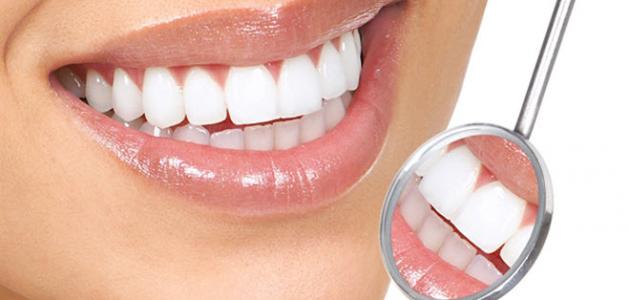 وصفات طبيعية للأسنان2