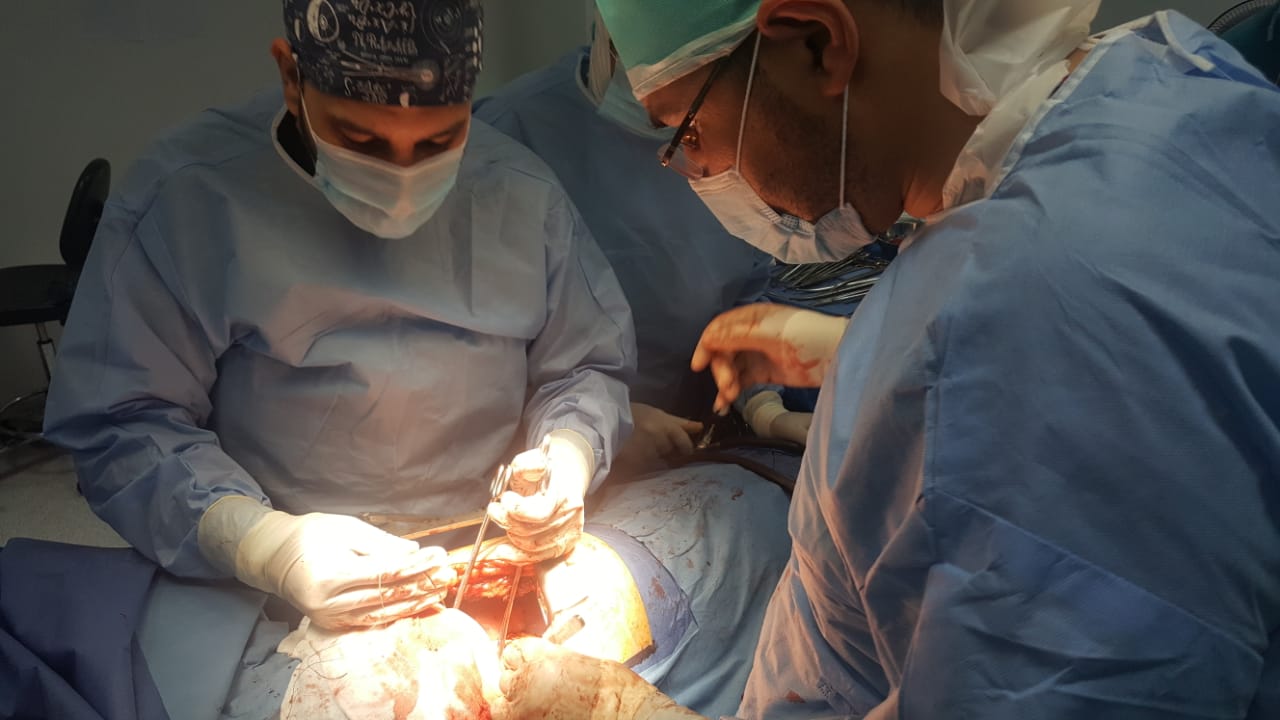 اجراء اول عملية استئصال ورم بالمرئ وتكوين أنبوبة من المعدة وتمريرها داخل الصدر لسيدة بمستشفى اورام الاسماعيلية (6)