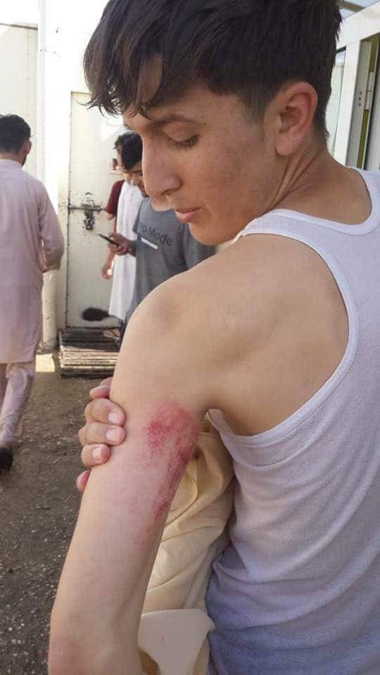تعرض طالب افغانى لجروح بسبب انتقاده اردوغان