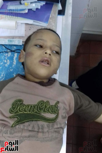 صور تفاصيل جريمة تعذيب طفل بإطفاء سجائر بجسده على يد والدته وخطيب شقيقته بالدقهلية ووالده يتهم زوجته وابنته وخطيبها بتعذيبه لمشاهدته لهم فى أوضاع مخلة الأمن يقبض على المتهمين والصحة تم احتجازه