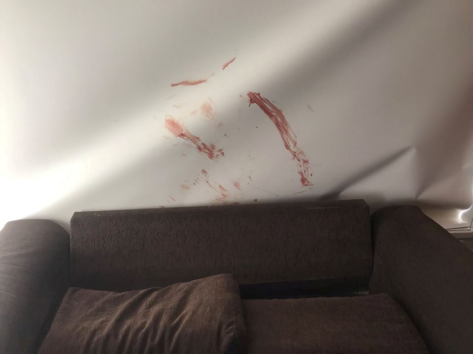 دماء على حائط المنزل إثر إصابة الكنغر