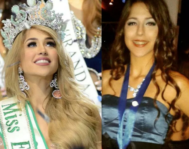 صور.. انتقادات لملكة جمال الكون الفنزويلية ومتابعون: "ملكة بلاستيكية