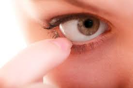 العدسات اللاصقة يمكن ان تسبب حكة العين