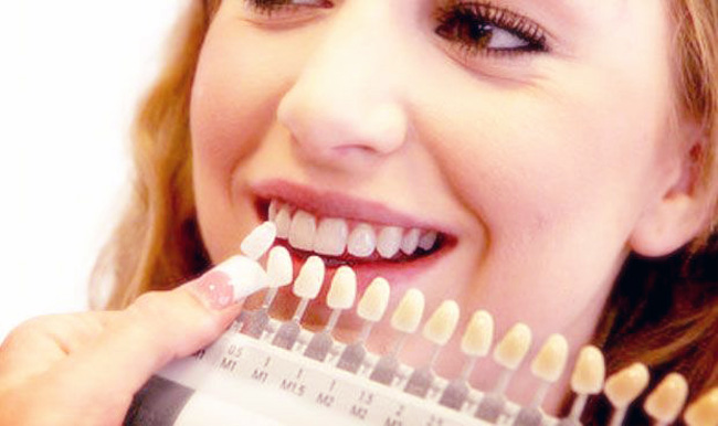 اسباب اصفرار الاسنان منها بعض المواد المستخدمة فى الحشو